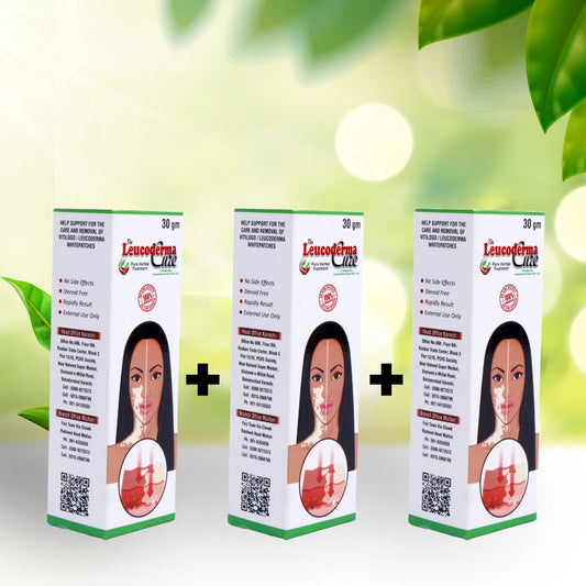 Leucoderma Cream Only