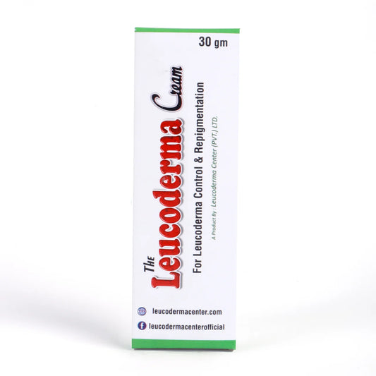 Leucoderma Cure with Cream